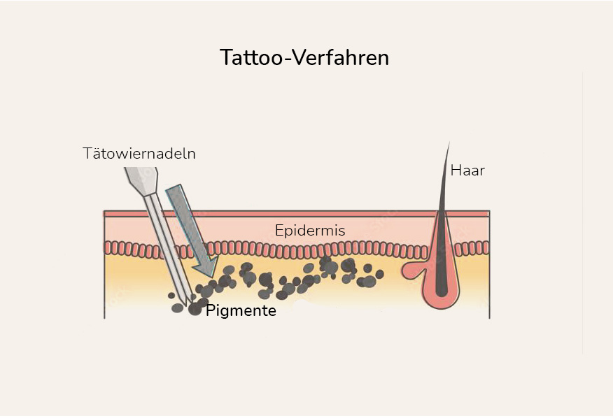 wie funktioniert eine tätowierung, was passiert in die Haut wann man tätowiert