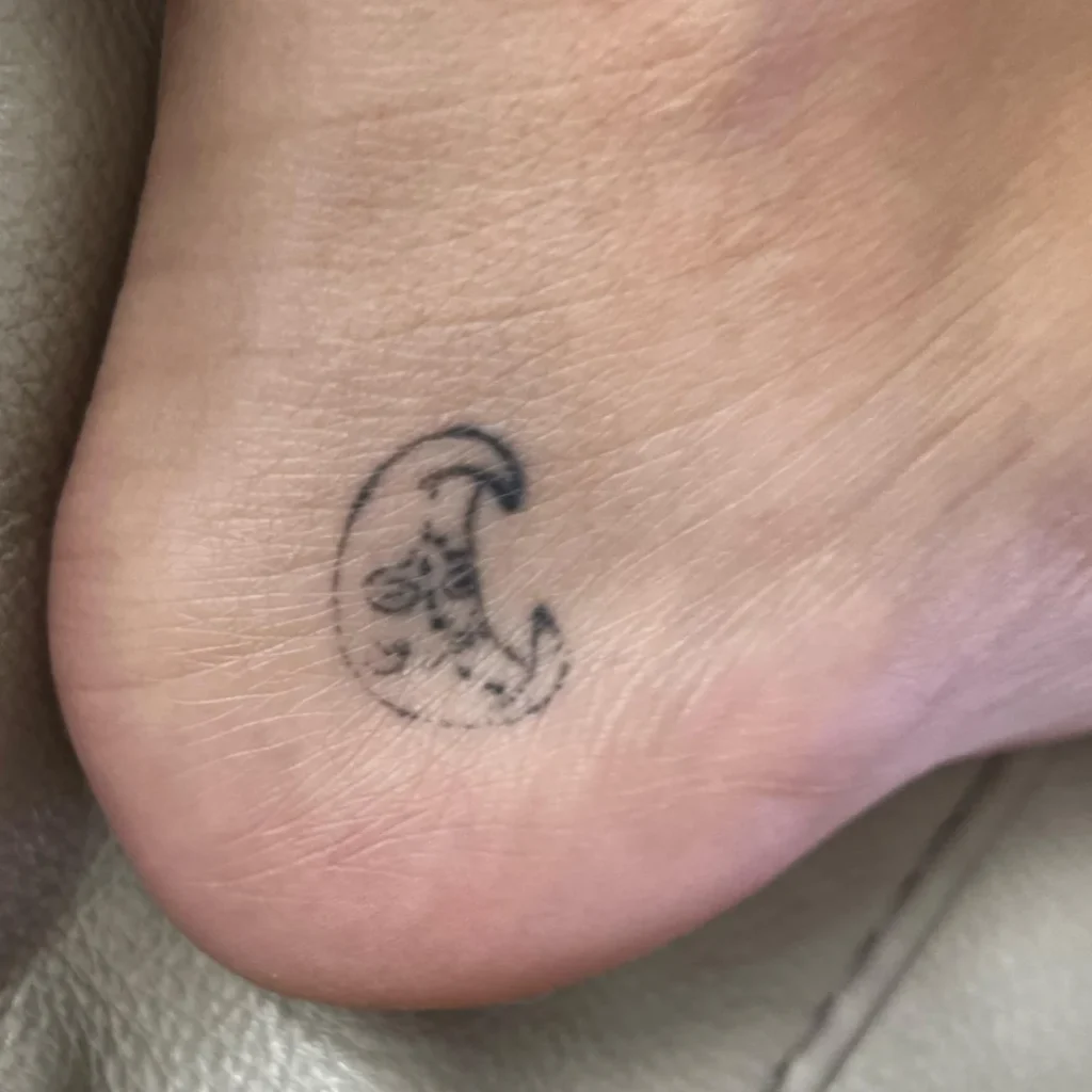 tattoo fade, tattoo auf der hornhaut heilt schlecht, sad moon tattoo, traurig mond tattoo verschwindet, schlechte heilung bei fuss tattoo, schlecht geheilte ferse tattoo