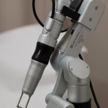 Pico-Laser Tattooentfernung Behandlung in Zürich – schnelle und effektive Lasertherapie
