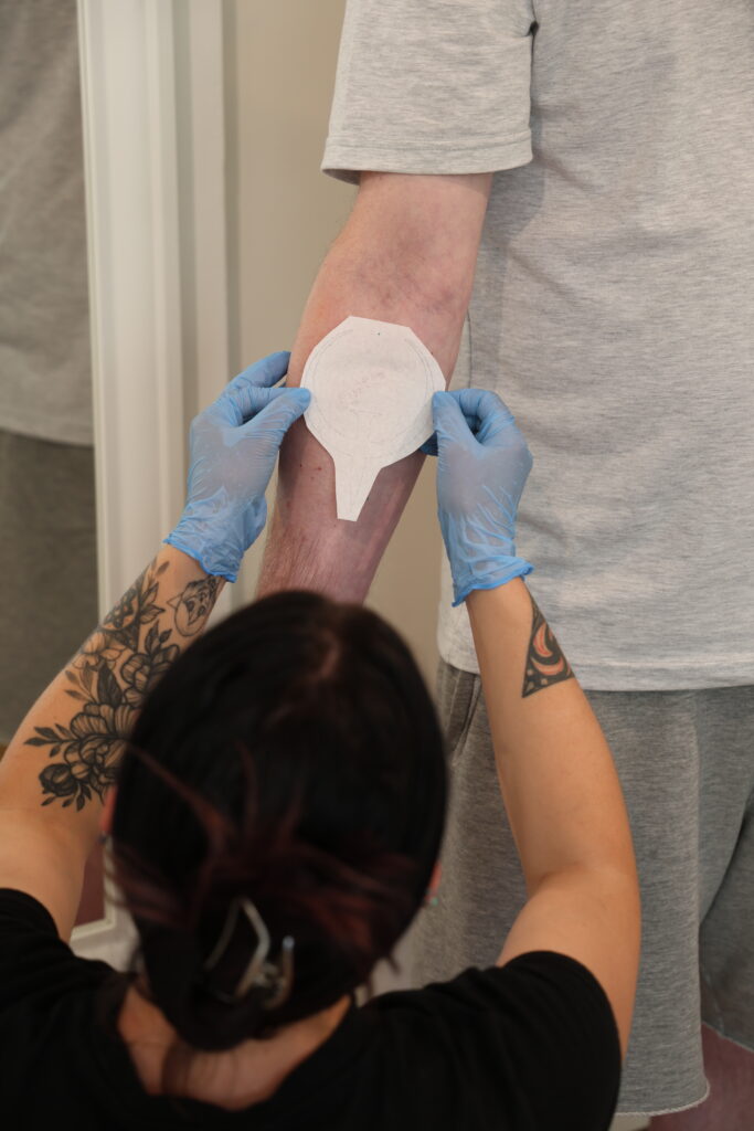 Stencil Tattoo: Der Tattoo Artist platziert das Stencil auf der Haut des Kunden.